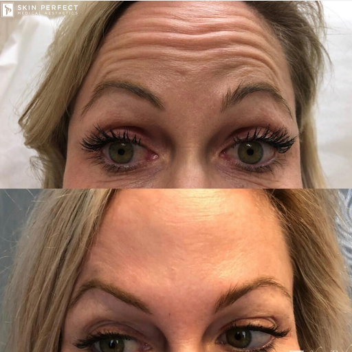 Explore 2007 tattoo ideas, creative tattoo ideas in Whittier, available at Skin Perfect Medical Aesthetics