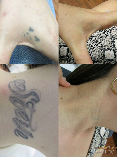 Explore cute turtle tattoo ideas, creative tattoo ideas in Houston, available at Houston Tattoo Removal Clinic