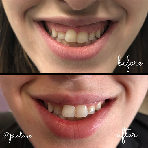 Explore family tree tattoo ideas for guys, creative tattoo ideas in Glendale, available at Prolase