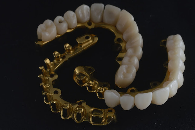 Digital dentures Glasgow, scan and fit - Glasgow