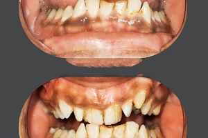 Dhimahim Detailed Dental Studio Memnagar image