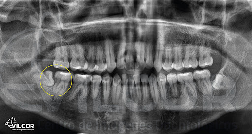 VilCor Centro de Imágenes Odontólogicas
