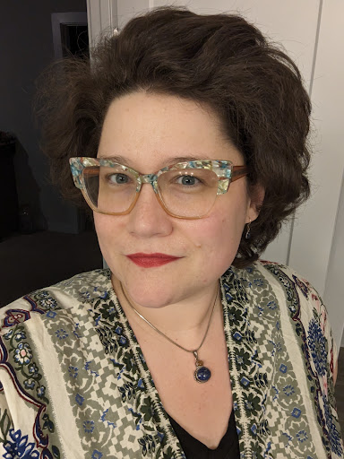 Explore butterfly thigh tattoo ideas, creative tattoo ideas in Powell, available at A Younger You Aesthetics