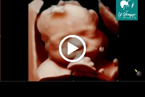 1st Glimpse 3D/4D Ultrasound image