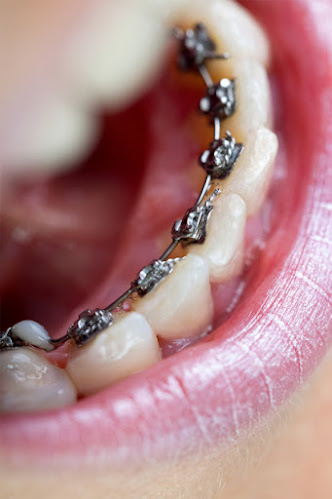 Isabelle Grier Orthodontiste - Dentiste