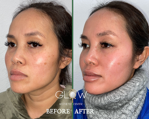 Glow Aesthetic Center Encino image