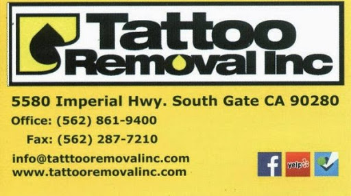 Explore scale tattoo ideas, creative tattoo ideas in South Gate, available at Tattoo Removal Inc