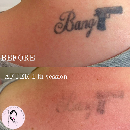 Explore element tattoo ideas, creative tattoo ideas in Naples, available at Laser Tattoo Removal Services