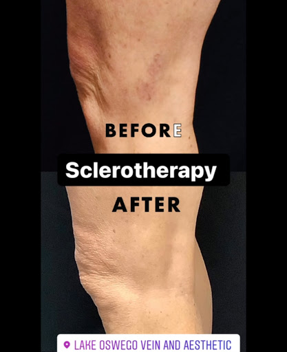 Explore tattoo ideas for memorial of father, creative tattoo ideas in Lake Oswego, available at Lake Oswego Vein and Aesthetic LOVA