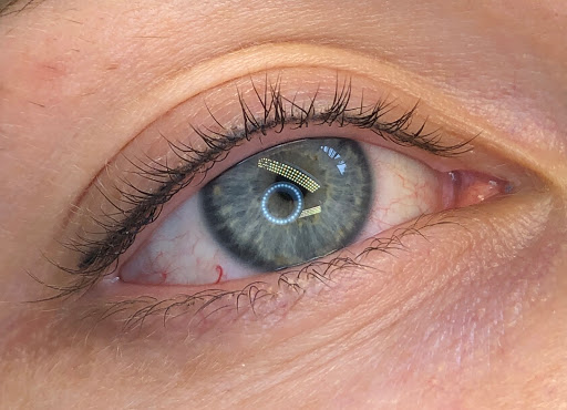 Skin Care Clinic «Timeless Skin Spa», reviews and photos, 413 Monterey Ave, Los Gatos, CA 95030, USA