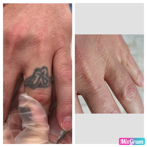 Explore cross tattoo cover up ideas, creative tattoo ideas in Longview, available at Vanish Laser Aesthetics