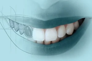 Dentista - Dra. Angélica Rodriguez - Dentista en chihuahua image