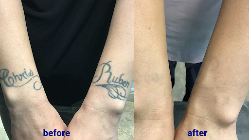 Explore evolution tattoo ideas, creative tattoo ideas in Sheffield Lake, available at TakeTatt Tattoo Removal