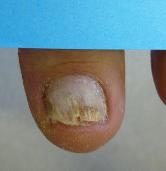 Queen's Park Chiropody - Queen's Park Chiropody