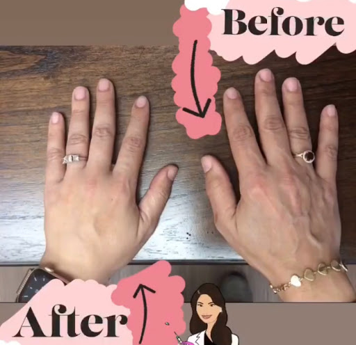 Explore blackbear tattoo ideas, creative tattoo ideas in Lake Oswego, available at Lake Oswego Vein and Aesthetic LOVA