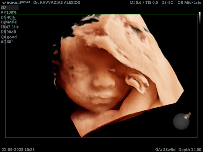 Αριθμός τηλεφώνου Δρ. Αλέξιος Καββαδίας, Μαιευτήρας - Χειρουργός Γυναικολόγος