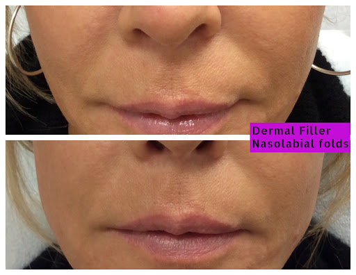 Explore jamaican tattoo ideas, creative tattoo ideas in Lake Oswego, available at Lake Oswego Vein and Aesthetic LOVA