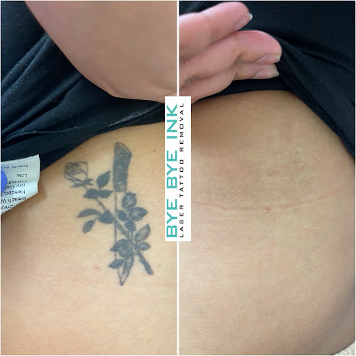 Explore neck tattoo men ideas, creative tattoo ideas in Middle Village, available at Bye Bye Ink Laser Tattoo Removal