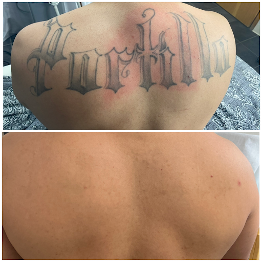 Explore forearm cover up tattoo ideas, creative tattoo ideas in Scottsdale, available at The INK Eraser