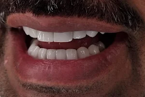 صفوة المهيدب لطب الأسنان الخبر الشمالية image