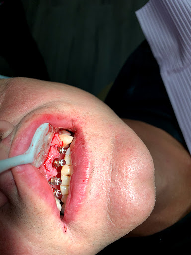 Dental implantology courses Minneapolis