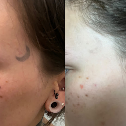 Explore sober tattoo ideas, creative tattoo ideas in Lake Jackson, available at Second Chance Laser Tattoo Removal