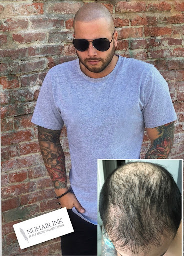 Explore 3 person tattoo ideas, creative tattoo ideas in Roseville, available at NuHair Ink. Scalp MicroPigmentation & Aesthetic Clinic of Sacramento