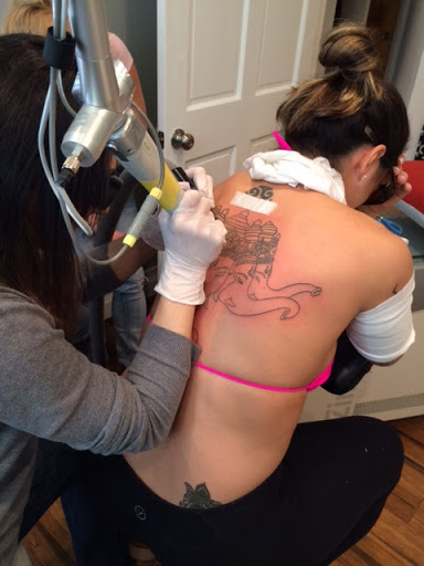 Explore neck sleeve tattoo ideas, creative tattoo ideas in Middle Village, available at Bye Bye Ink Laser Tattoo Removal