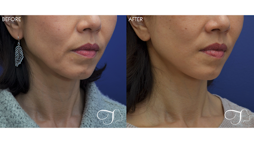 Kristina Tansavatdi, MD Tansavatdi Cosmetic & Reconstructive Surgery image