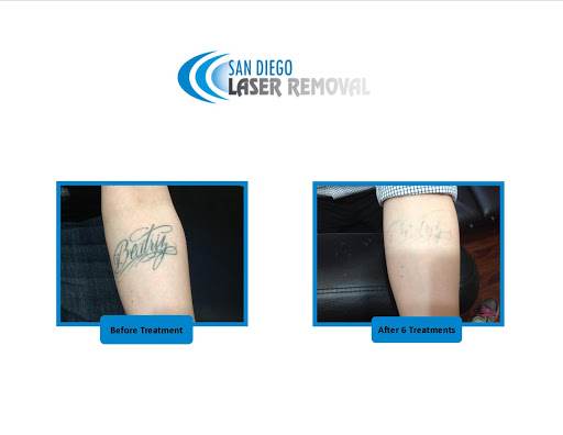 Explore tattoo ideas for autism, creative tattoo ideas in San Diego, available at Removery Tattoo Removal & Fading