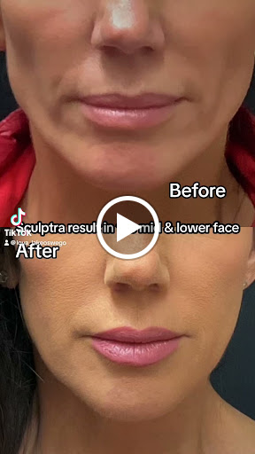 Explore september birth tattoo ideas, creative tattoo ideas in Lake Oswego, available at Lake Oswego Vein and Aesthetic LOVA