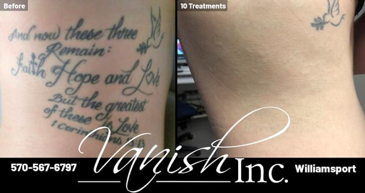 Explore horror tattoo ideas, creative tattoo ideas in Williamsport, available at Vanish Laser & Skin, Inc.
