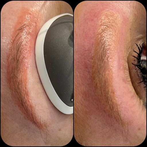 Explore cherry tattoo ideas, creative tattoo ideas in Medford, available at Get Faded Tattoo Removal