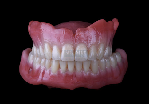 جميع 4 دنت - All 4 Dent