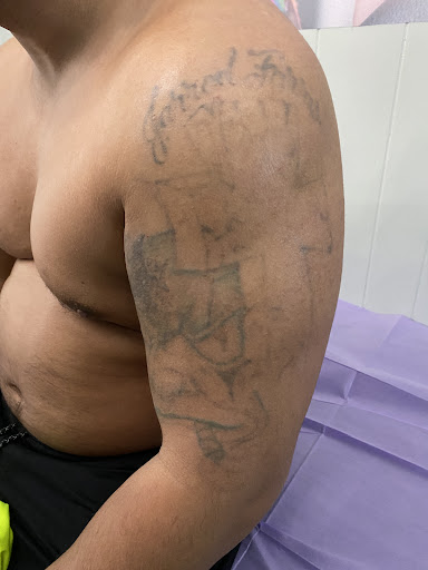 Explore tribal band tattoo ideas, creative tattoo ideas in Lake Jackson, available at Second Chance Laser Tattoo Removal