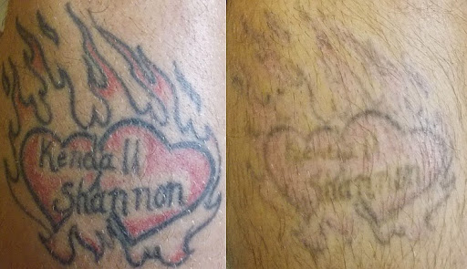 Explore coffee cup tattoo ideas, creative tattoo ideas in Weatherford, available at Vanish Laser Tattoo Removal and Skin Aesthetics