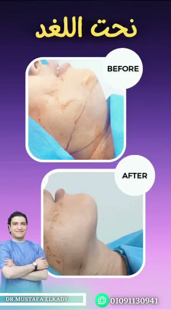 عيادة دكتور مصطفى القاضى للتجميل