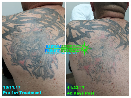 Explore women's ankle tattoo ideas, creative tattoo ideas in Bethlehem, available at New Wave Laser Tattoo Removal