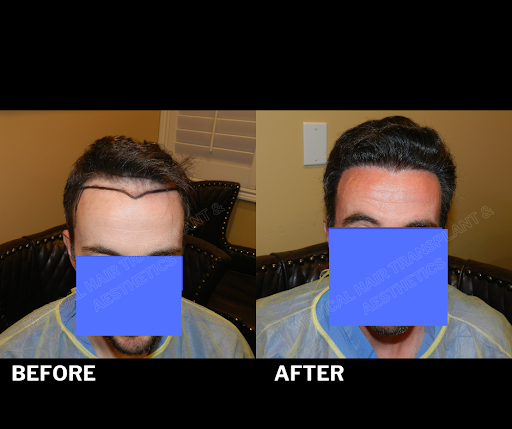 Medical Hair Transplant & Aesthetics image