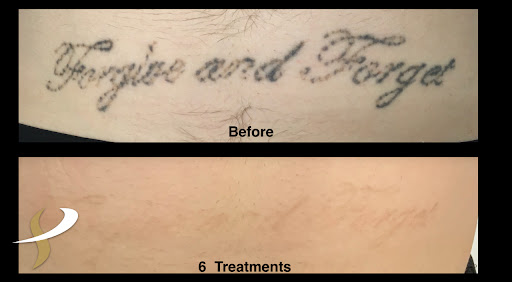 Explore tattoo ideas for guys back, creative tattoo ideas in Spokane, available at Premier Body and Laser