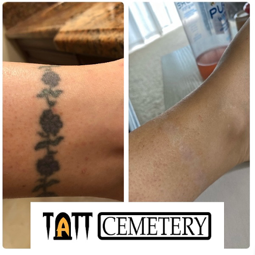 Explore couple ring finger tattoo ideas, creative tattoo ideas in Fort Myers, available at Laser Tattoo Removal by Tatt Cemetery