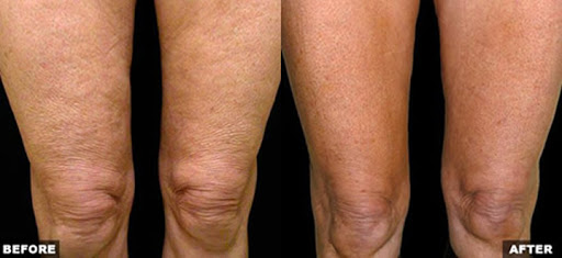 Medical Spa «Pur Skin Clinic», reviews and photos, 307 Bell St #104, Edmonds, WA 98020, USA