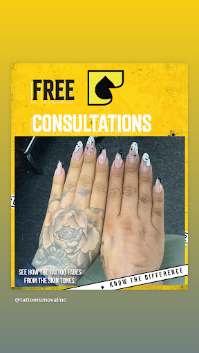 Explore sanji tattoo ideas, creative tattoo ideas in South Gate, available at Tattoo Removal Inc