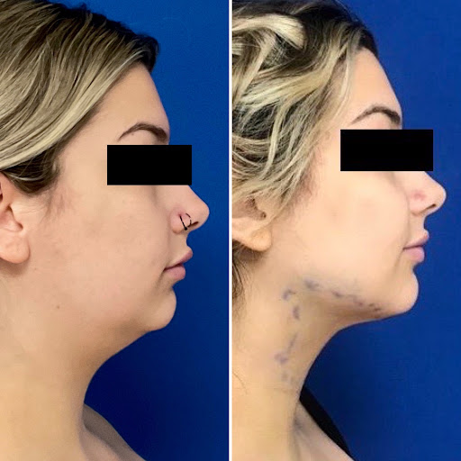 Los Angeles Plastic Surgery image