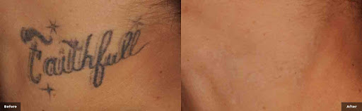 Explore cute butterfly tattoo ideas, creative tattoo ideas in Princeton Junction, available at Princeton Aesthetics