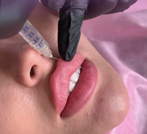 Medical Spa «Lavender Med Spa», reviews and photos, 3675 Crestwood Pkwy #400, Duluth, GA 30096, USA