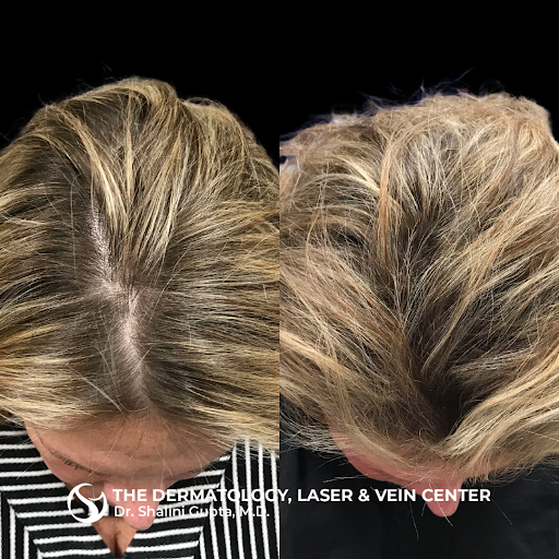 Explore lean tattoo ideas, creative tattoo ideas in Cincinnati, available at The Dermatology, Laser & Vein Center