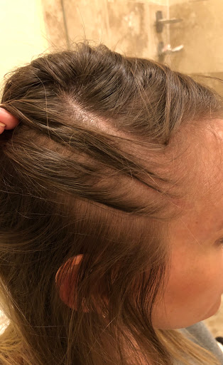 Hair Replacement Service «Harklinikken», reviews and photos, 4238 W Kennedy Blvd #1, Tampa, FL 33609, USA