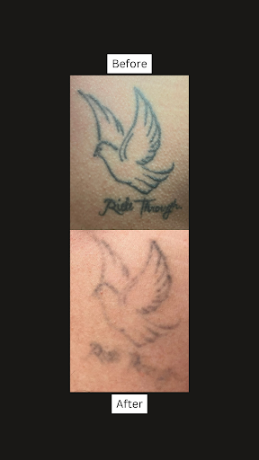 Explore black widow tattoo ideas, creative tattoo ideas in San Antonio, available at San Antonio Tattoo Removal Co.