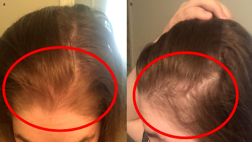 Trichology Hair Loss Clinic